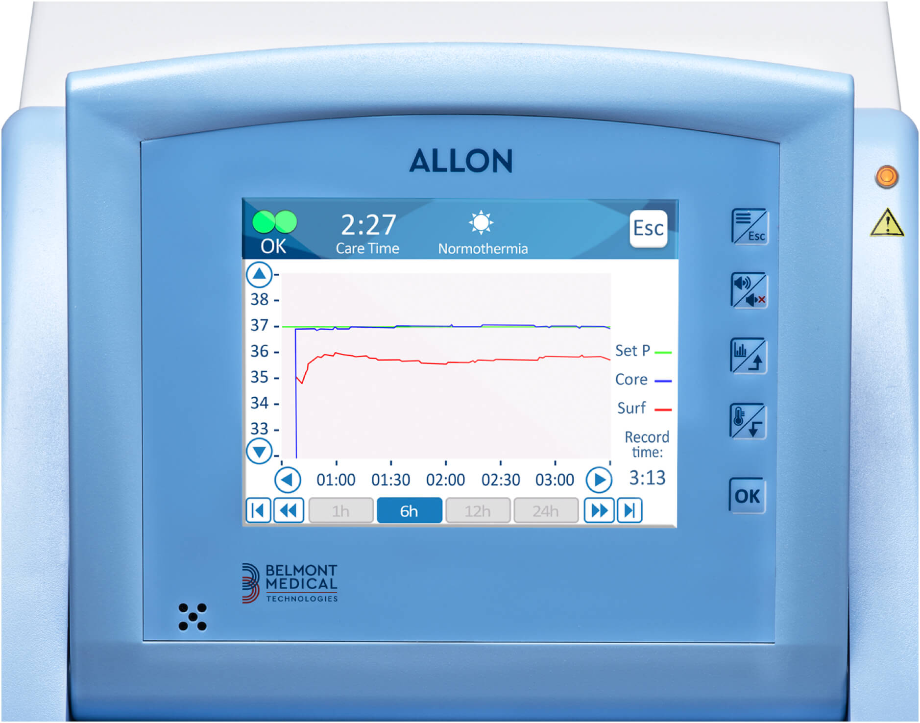 Allon touch screen showing patient temperature